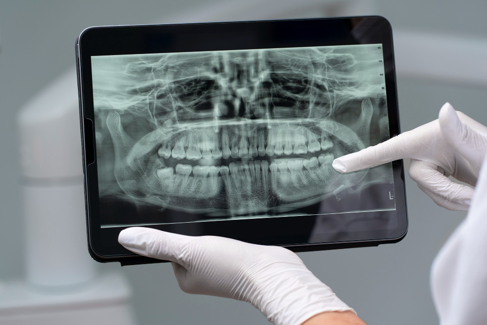 Digital X-Rays  Richmond Hill, NY