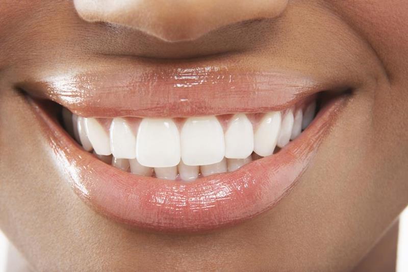 Amalgam Fillings
