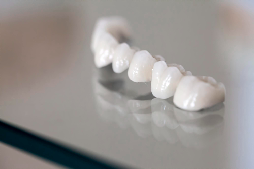 Porcelain Crowns in Richmond Hill