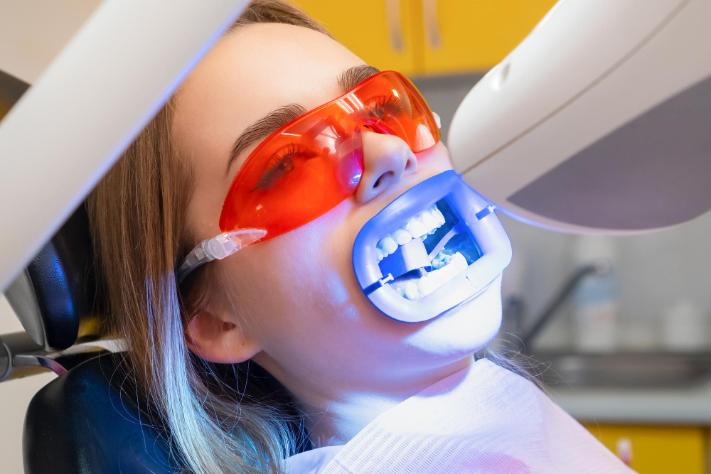 Teeth Whitening in Richmond Hill